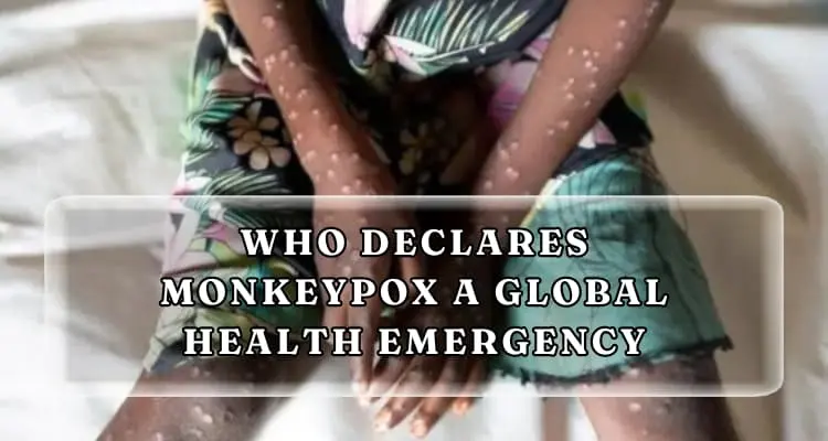 More Information; WHO Declares Monkeypox a Global Health Emergency