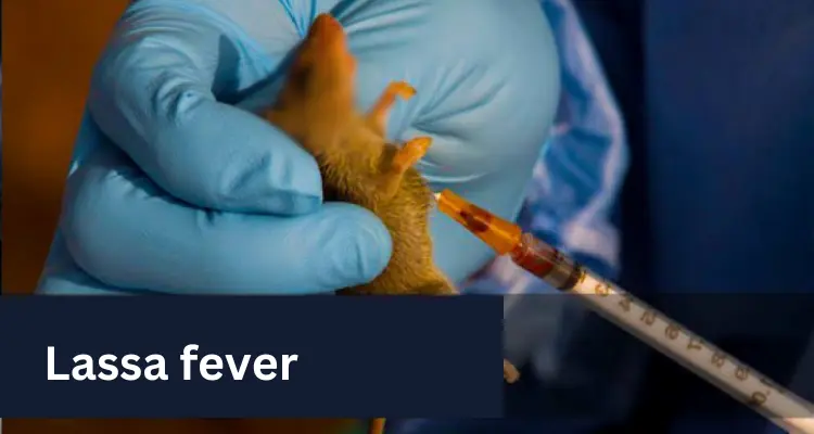 Lassa fever