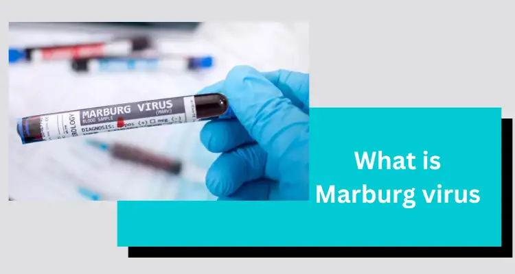 What is Marburg virus